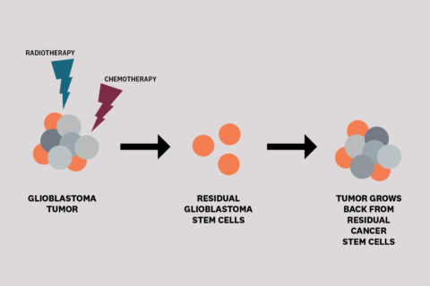 glioblastoma development