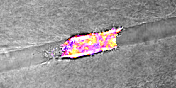 Cancer cell migration illustration