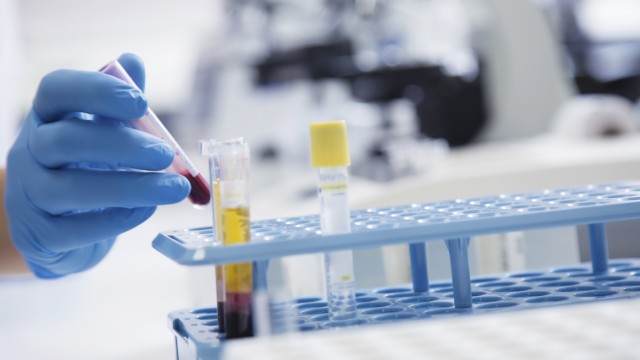 Hematopoietic stem cells are taken from the patient’s bone marrow or blood, then their immune stem is wiped out with chemotherapy.
