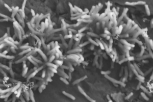 Rhodopseudomonas palustris