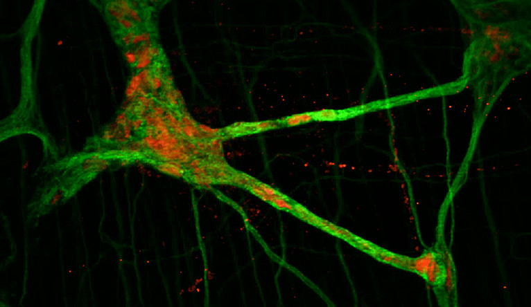 Image of the neuron network in the intestine