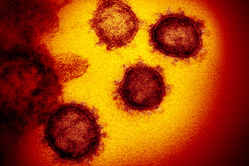 This transmission electron microscope image shows SARS-CoV-2—also known as 2019-nCoV, the virus that causes COVID-19. isolated from a patient in the U.S., emerging from the surface of cells cultured in the lab. Photo courtesy of the National Institute of Allergy and Infectious Diseases-Rocky Mountain Laboratories